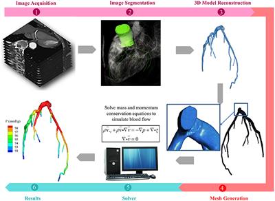 Computational Cardiovascular Mechanics: Modeling and Applications in Heart Failure